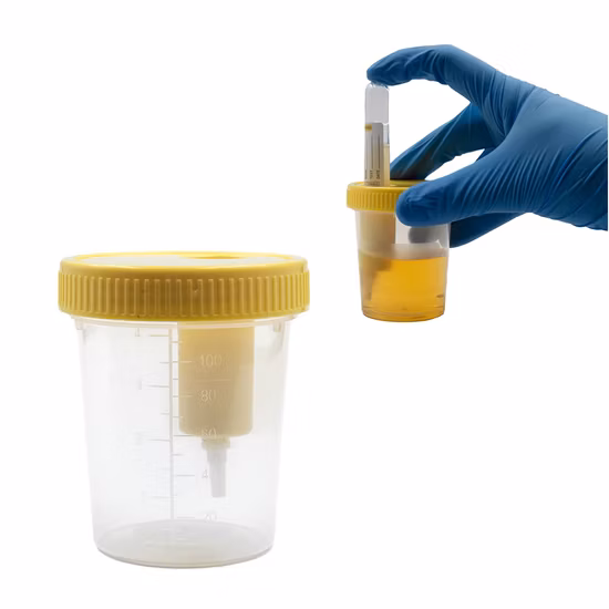 Medical Disposables Sterile Specimen Collector 30ml 60ml 100ml 120ml 150ml Stool Urine Container
