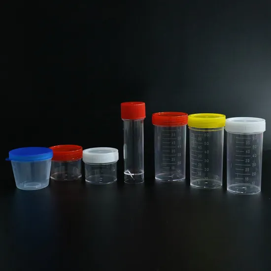Siny Factory Price Plastic 30ml Hospital Equipment Supply Medical Products Test Stool Sample Container