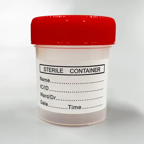 Siny Medical Manufacturer Disposable Sterile Specimen Cup Urine Container with CE ISO 