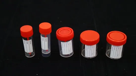 Disposable Medical Plastic 5ml Stool Container with Spoon for Stool Specimen Collection Use 
