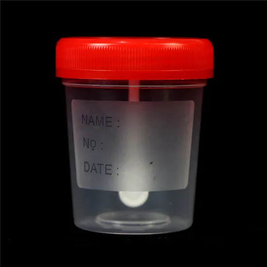 Screw Cup Sample Stool Specimen Collection Container Medical 