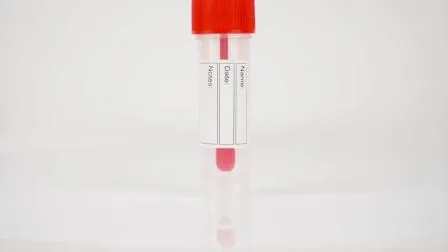 Disposable Plastic 25ml Stool Container with Spoon Skirted Bottom 