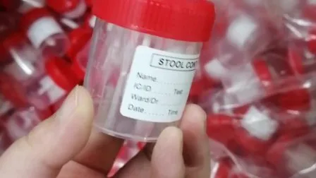30ml 60ml 100ml Wholesale Price Specimen Cup Stool Urine Sample Collection Container 